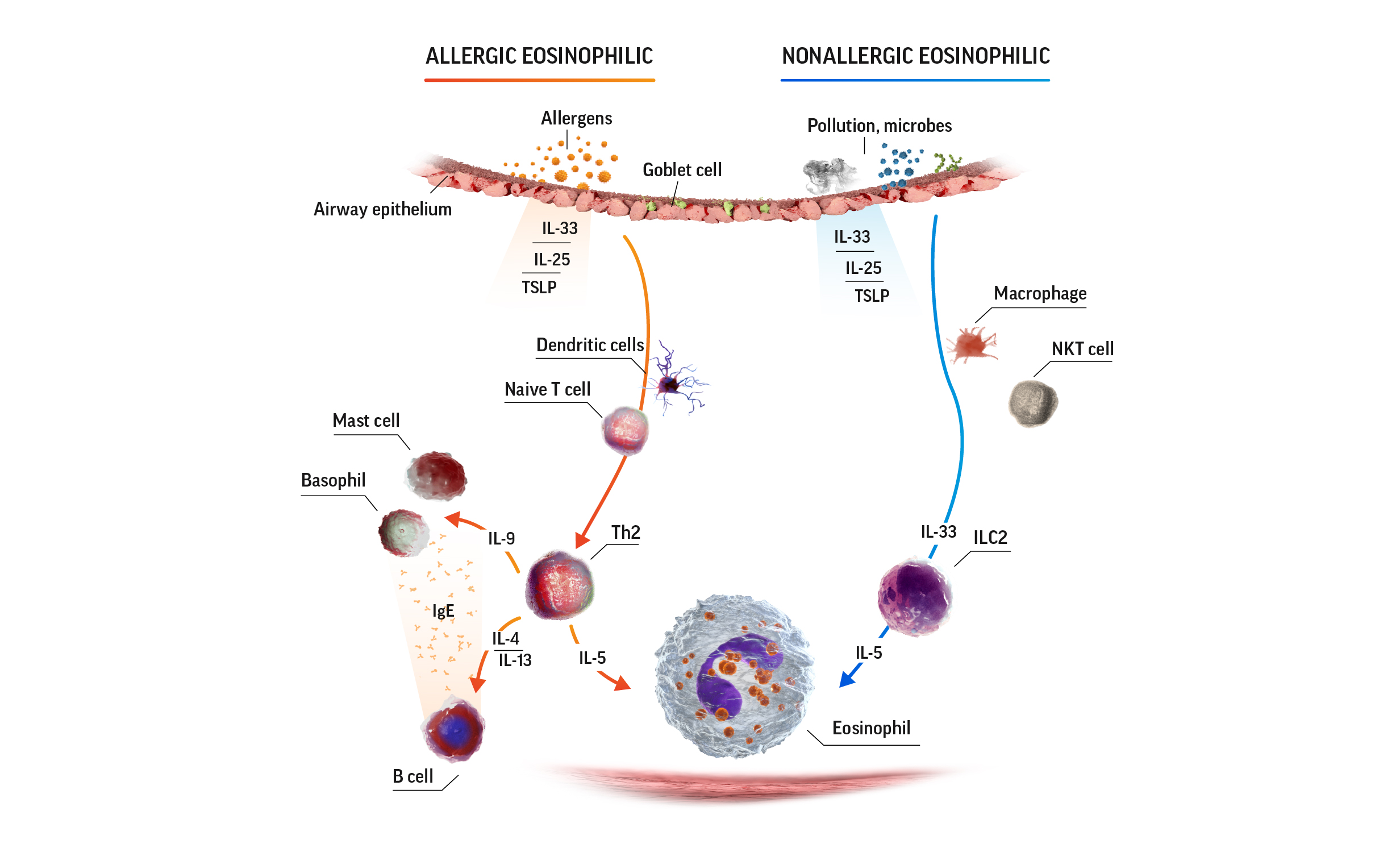 Eosinophiles Asthma