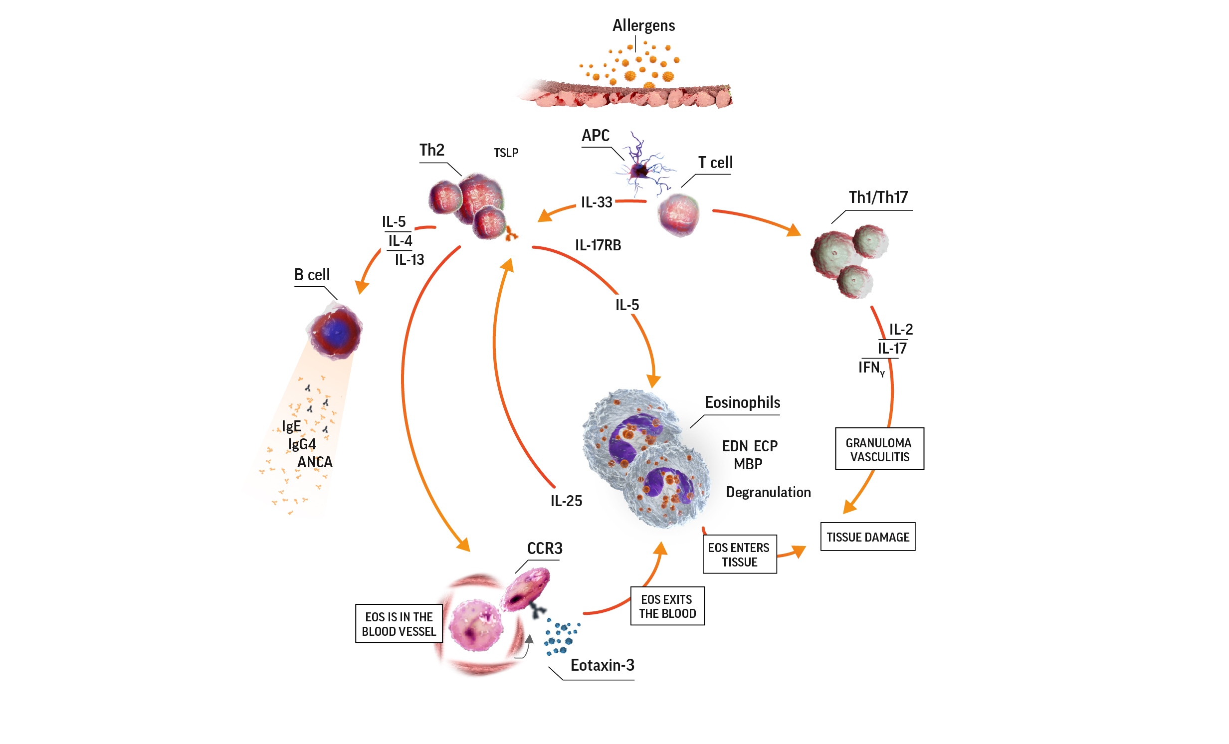 Diagram of eosinophilia in EGPA pathogenesis