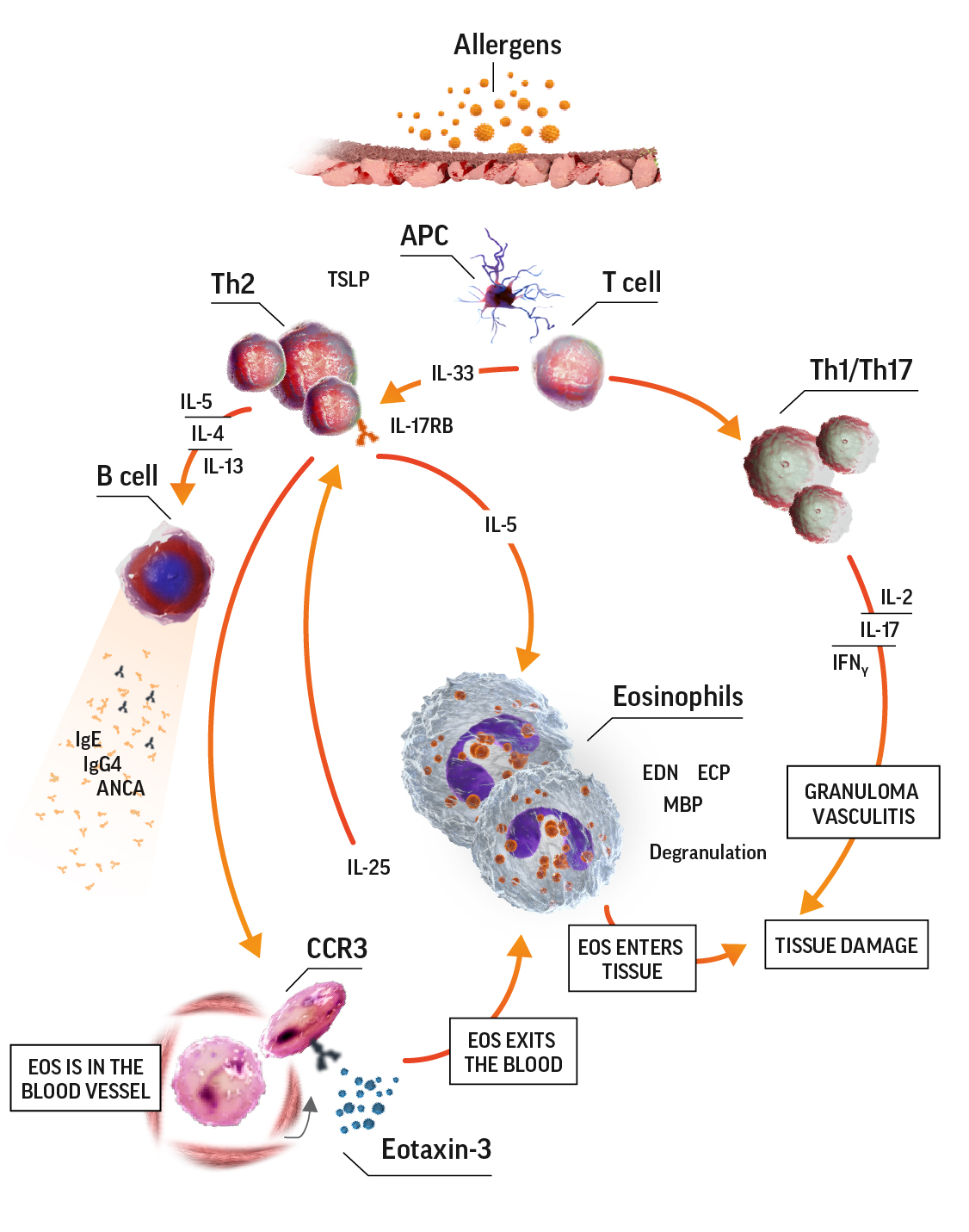 Eosinophilia in EGPA 