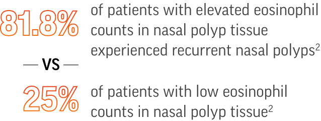81.8% of patients with elevated eosinophil counts in nasal polyp tissue experienced recurrent nasal polyps² - VS - 25% of patients with low eosinophil counts in nasal polyp tissue²